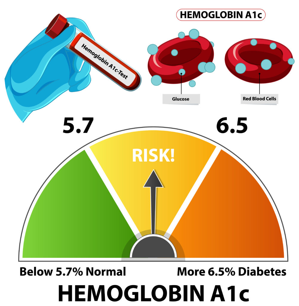 HbA1c टेस्ट क्या है और नॉर्मल कितना होना चाहिए: शुगर की लंबी कहानी को समझने का एक शांत और भरोसेमंद तरीका